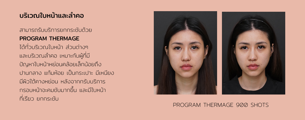 Thermage 8