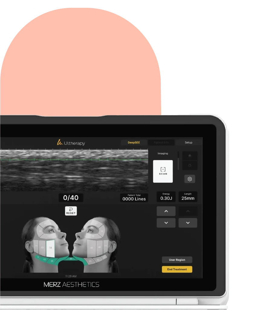 Ultherapy® PRIME 19