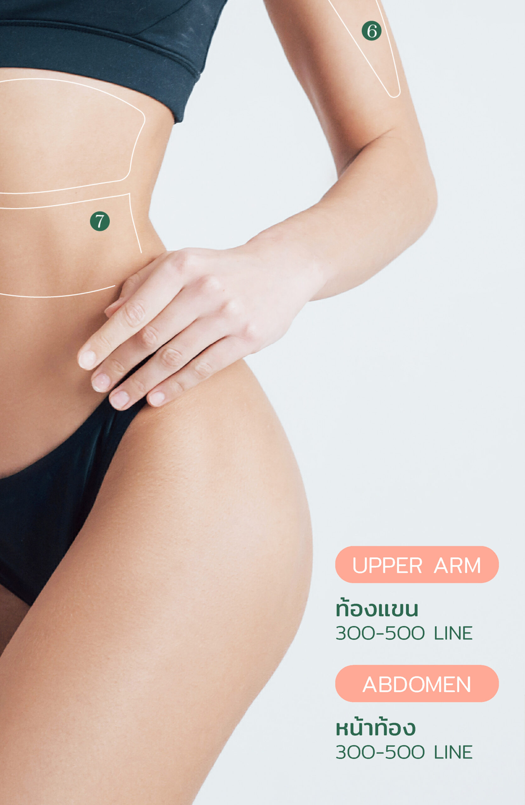Ultherapy® PRIME 14