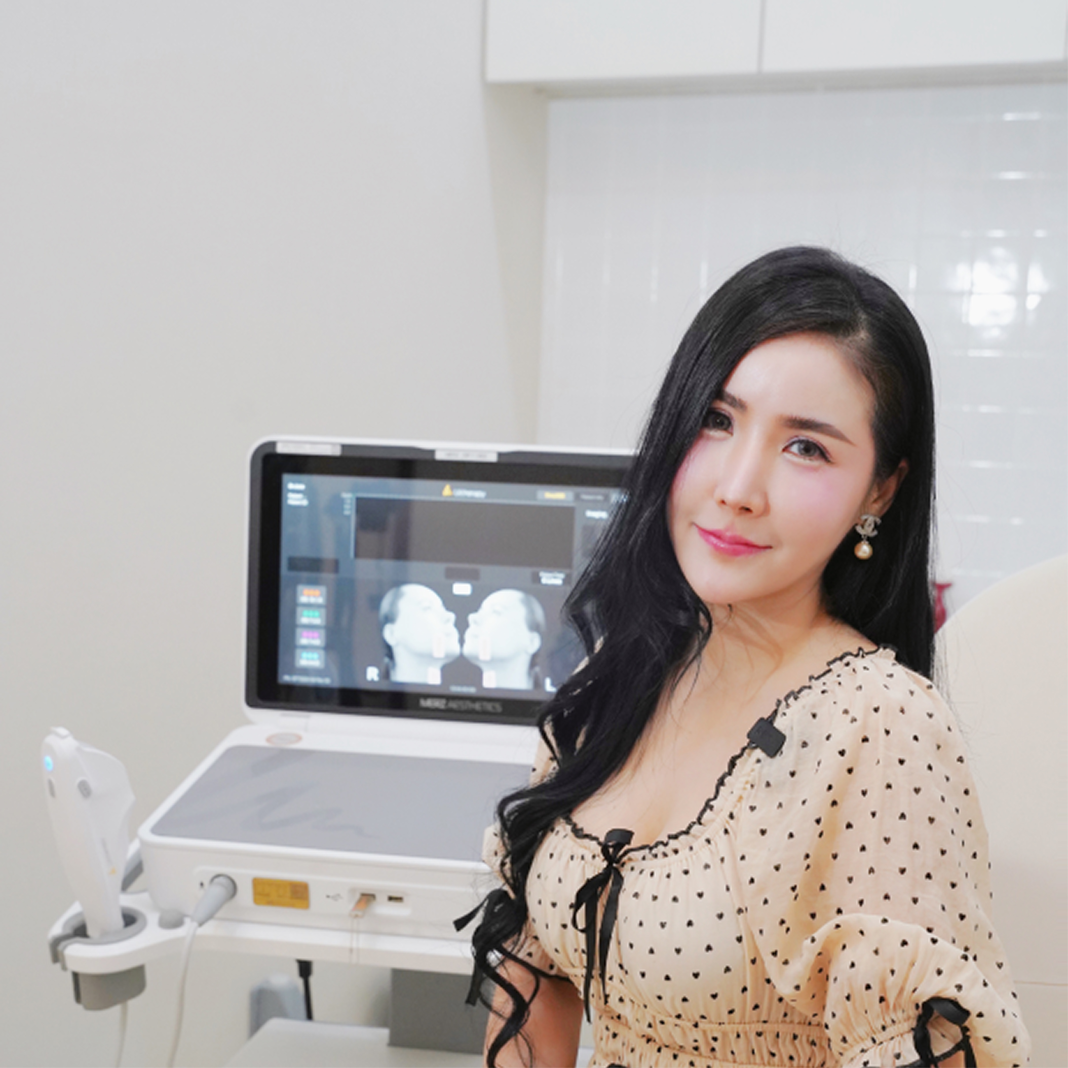 Ultherapy® PRIME 28 Screenshot 2025-02-08 at 17.27.32-12