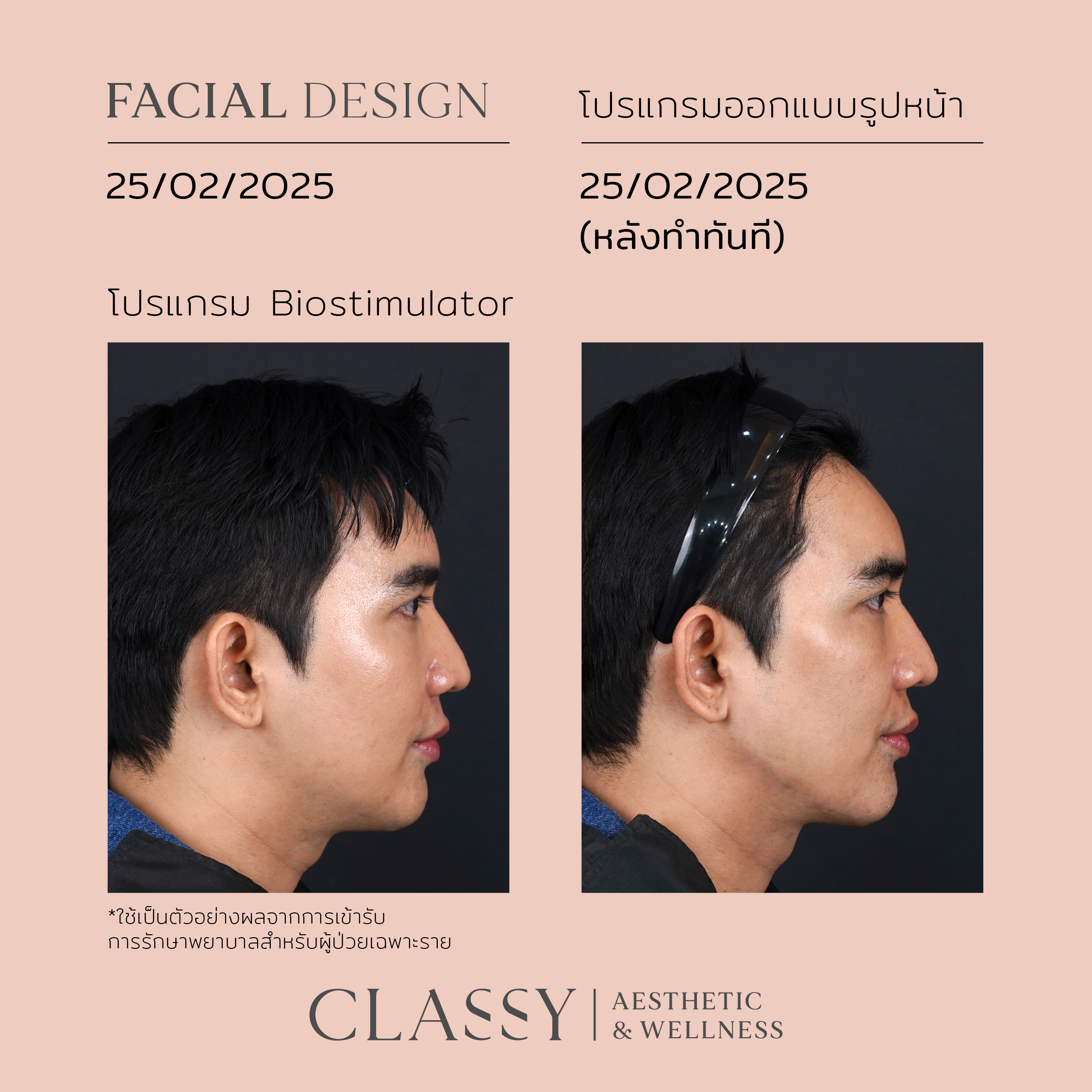 BA FACIAL DESIGN-01