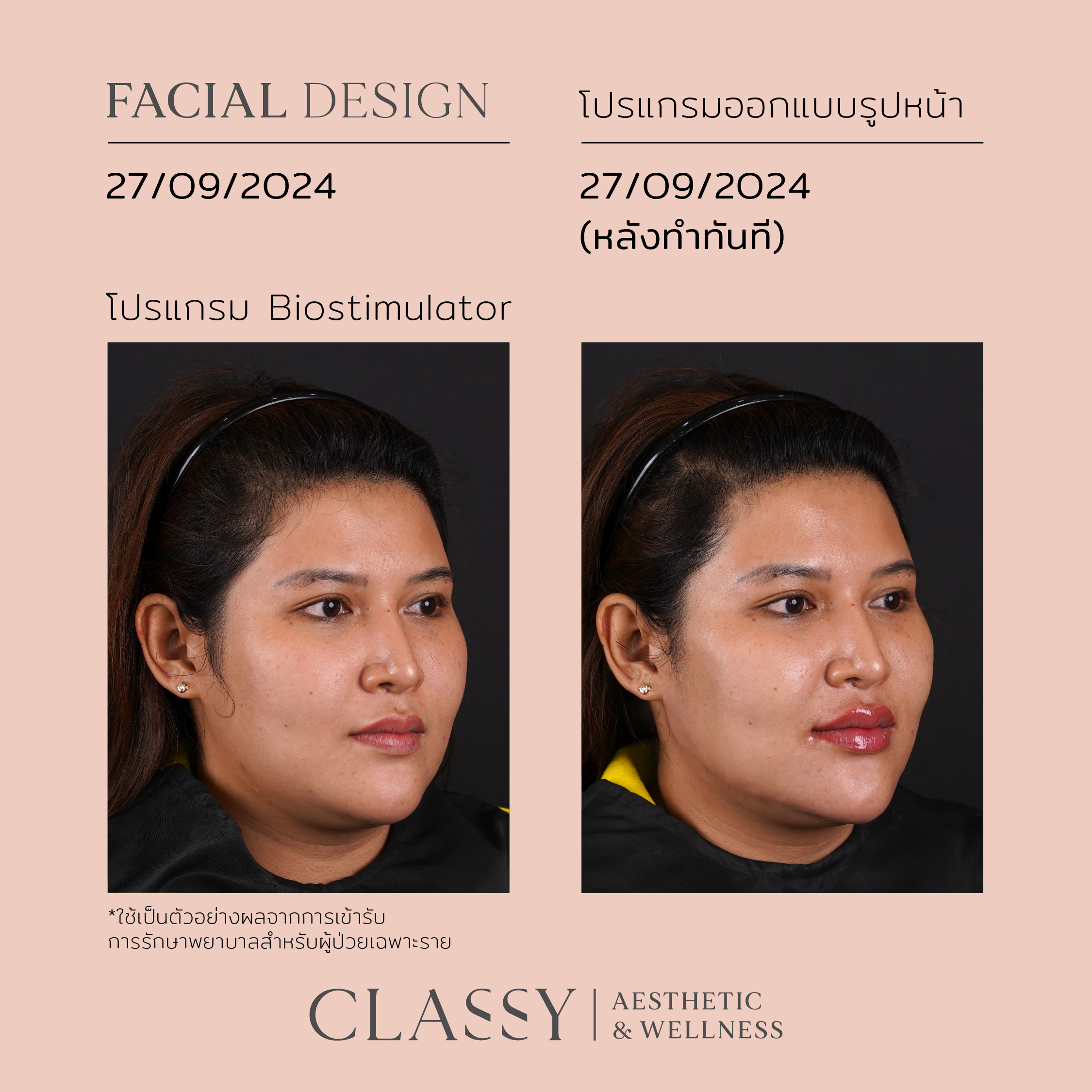 BA FACIAL DESIGN-01 5