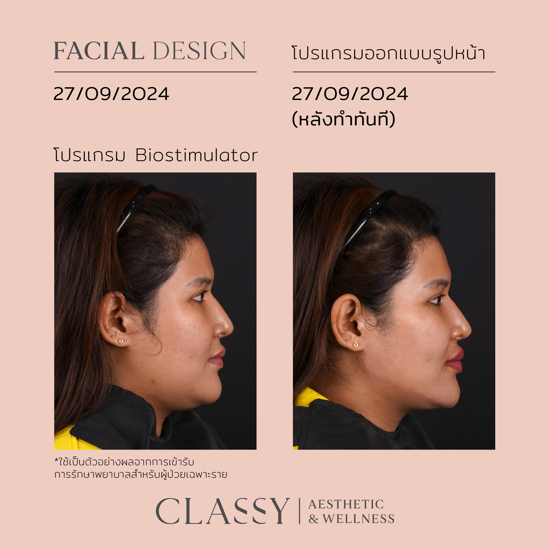 BA FACIAL DESIGN-02 5