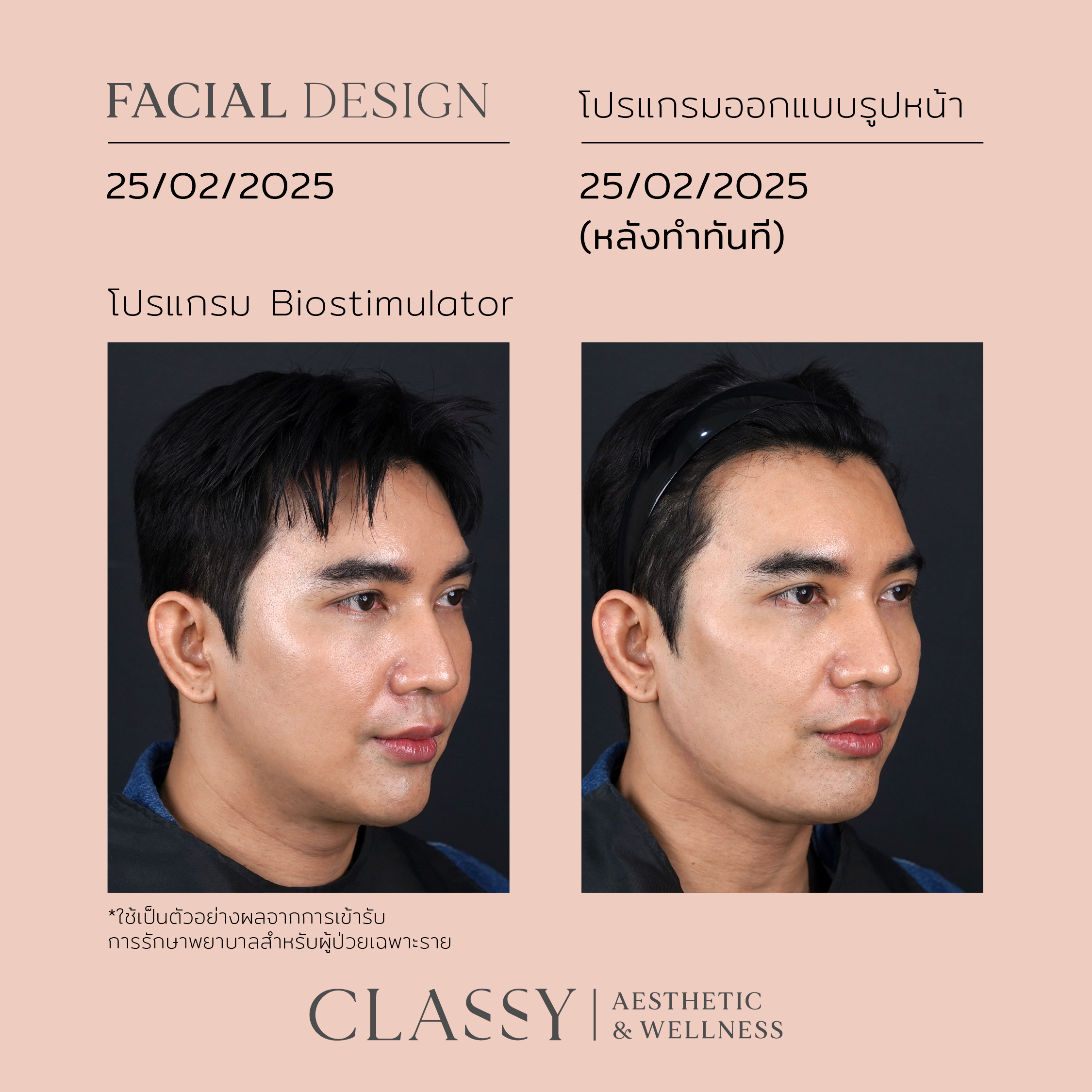 BA FACIAL DESIGN-02