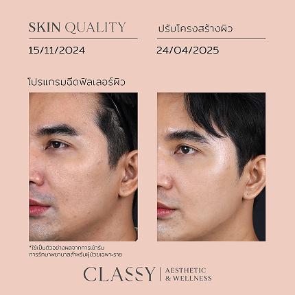 BA FACIAL DESIGN-15