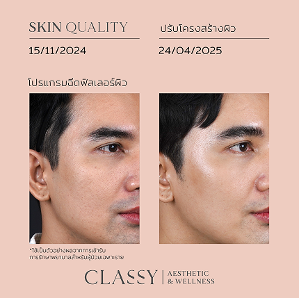 BA FACIAL DESIGN-17