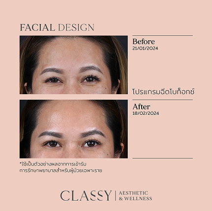 BA FACIAL DESIGN แนวนอน -01 3