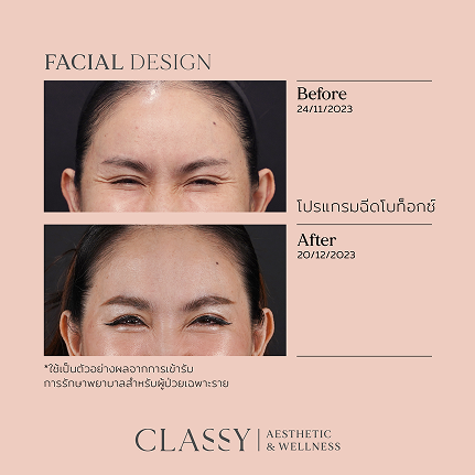 BA FACIAL DESIGN แนวนอน -03 4