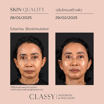 BA SKIN QUALITY-02 3