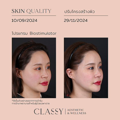 BA SKIN QUALITY-02 4