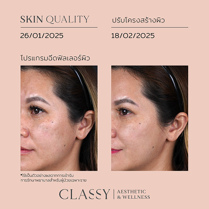 BA SKIN QUALITY-04