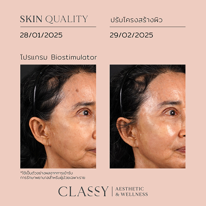BA SKIN QUALITY-04 3