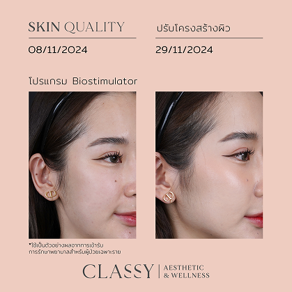 BA SKIN QUALITY-04