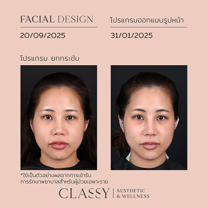 กระเตื้อง 0