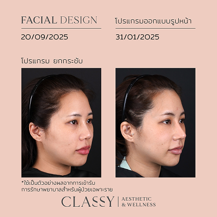 กระเตื้อง 45