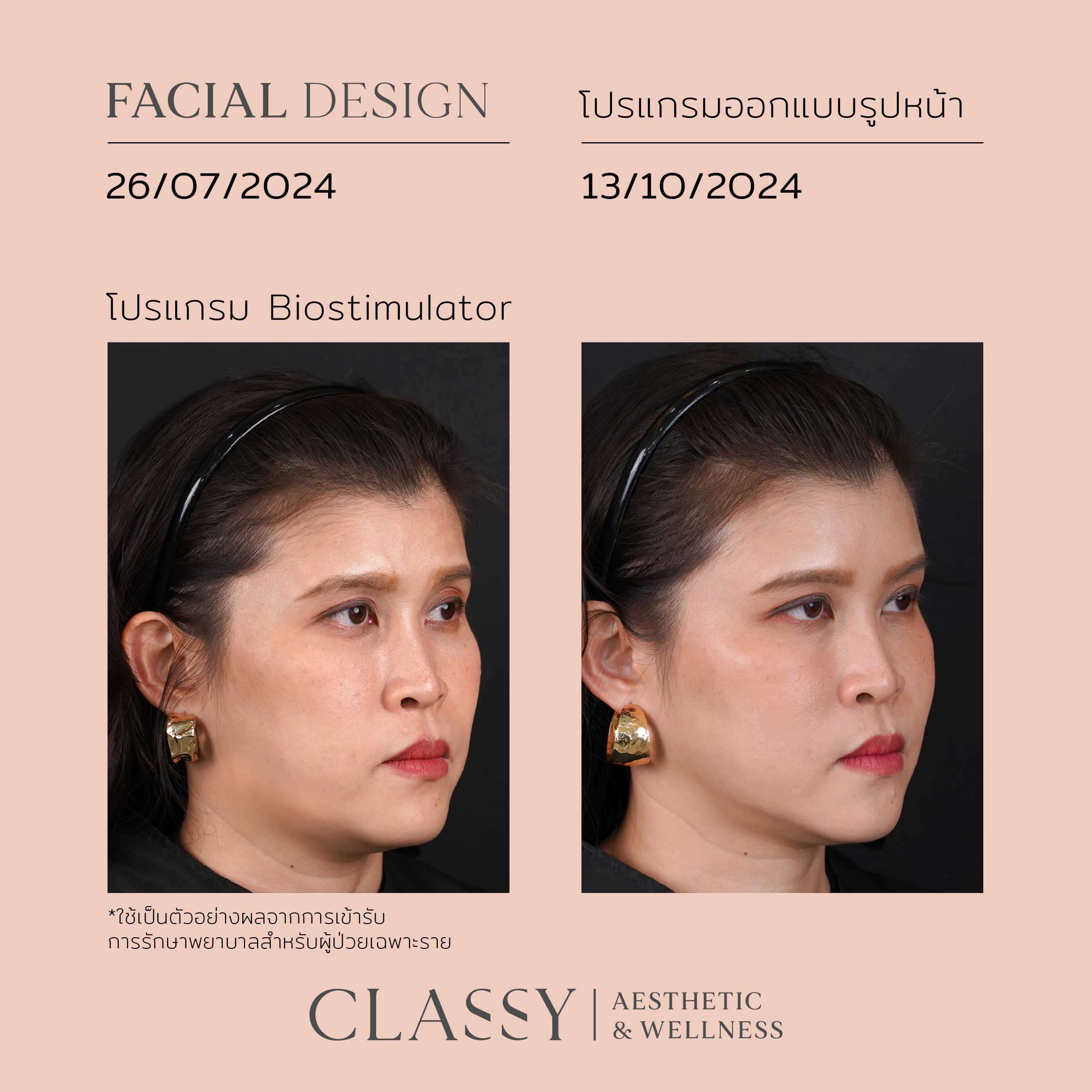 หมอส้ม-02