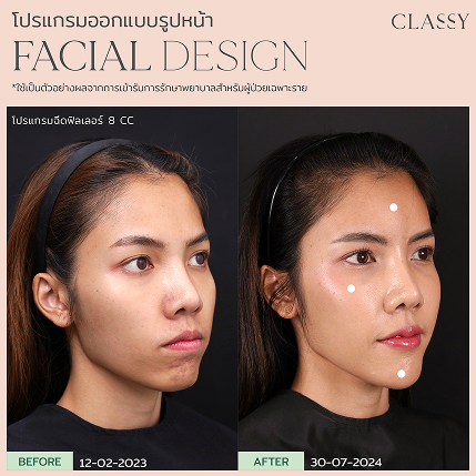 เทมเพลต รูปยาว-03 10