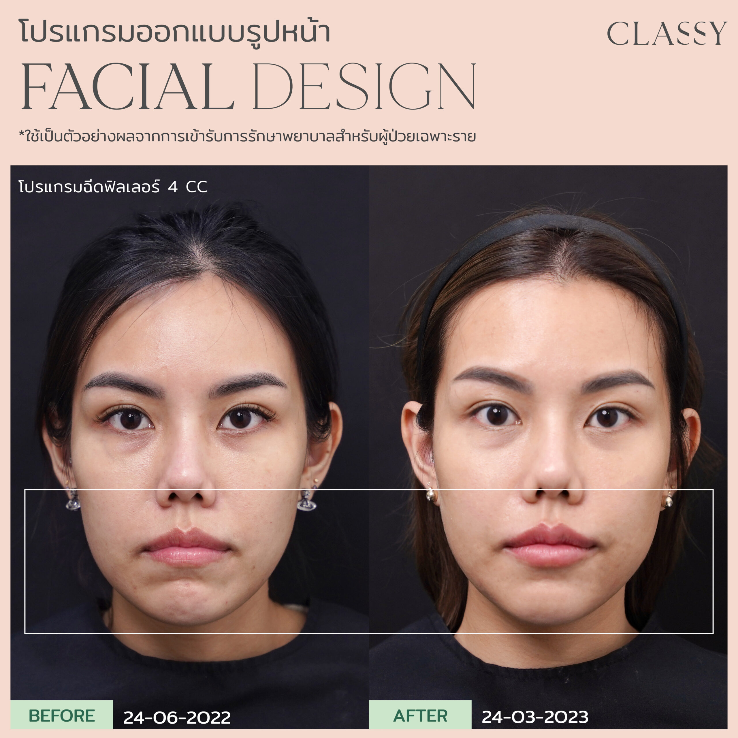 เทมเพลต รูปยาว-03 11
