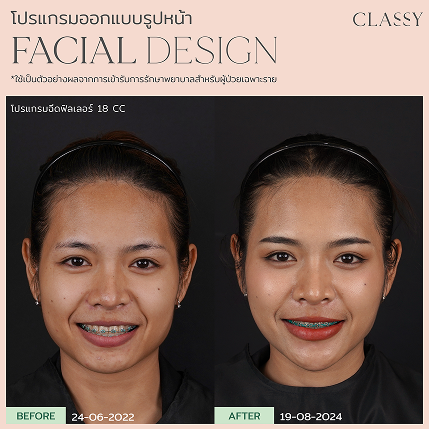 เทมเพลต รูปยาว-03 11