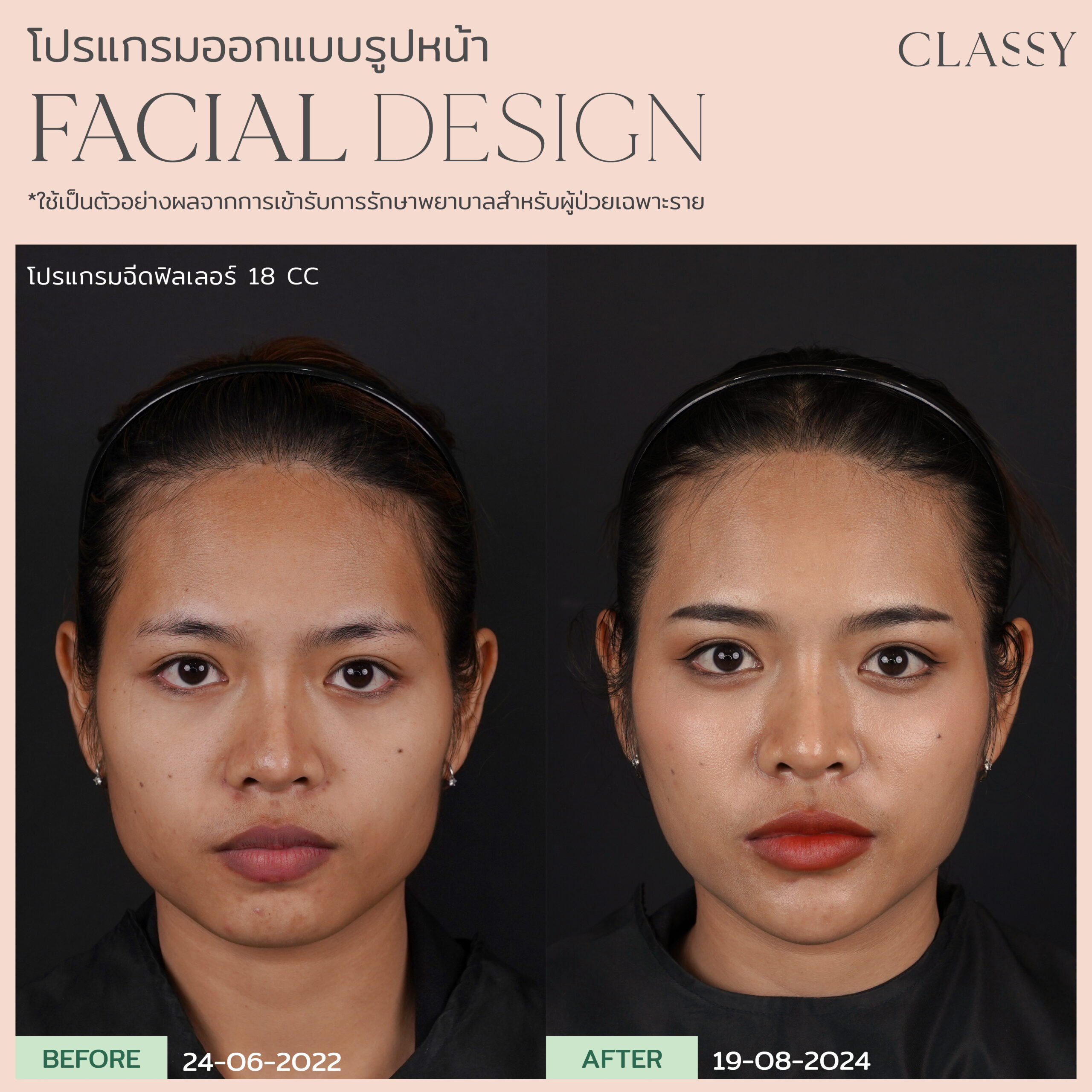 เทมเพลต รูปยาว-04 10