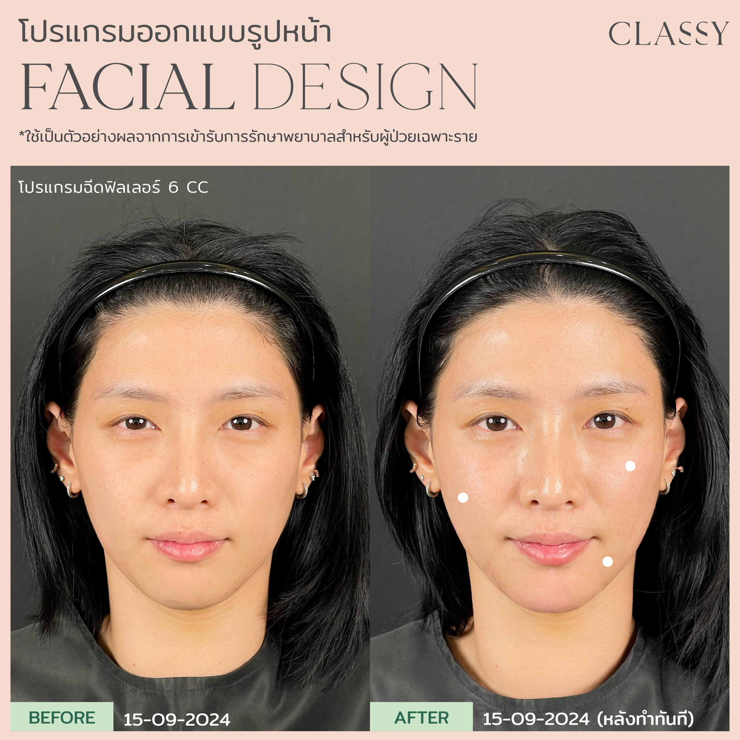 เทมเพลต รูปยาว-04 11