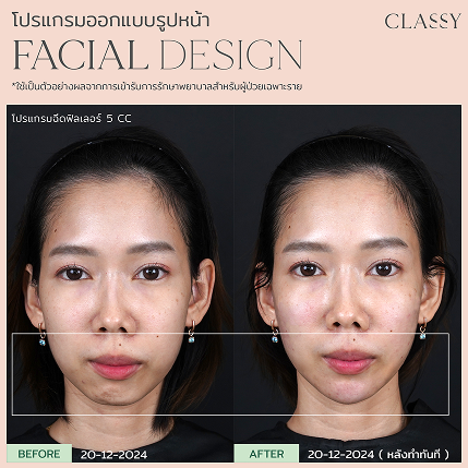เทมเพลต รูปยาว-04 16