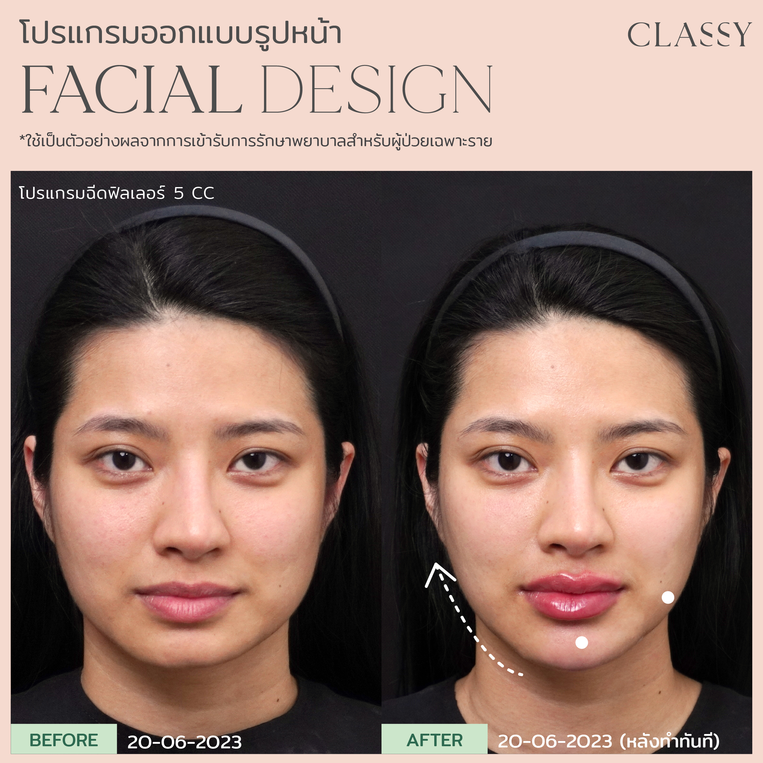 เทมเพลต รูปยาว-04 2