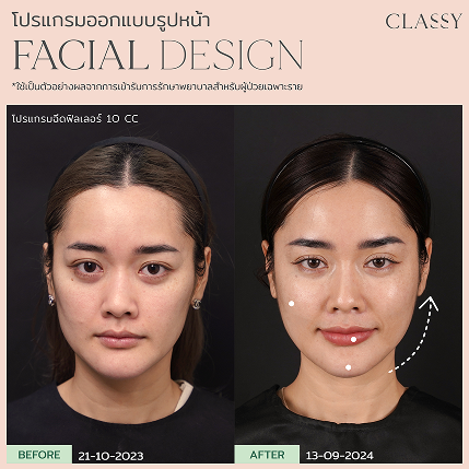 เทมเพลต รูปยาว-04 20