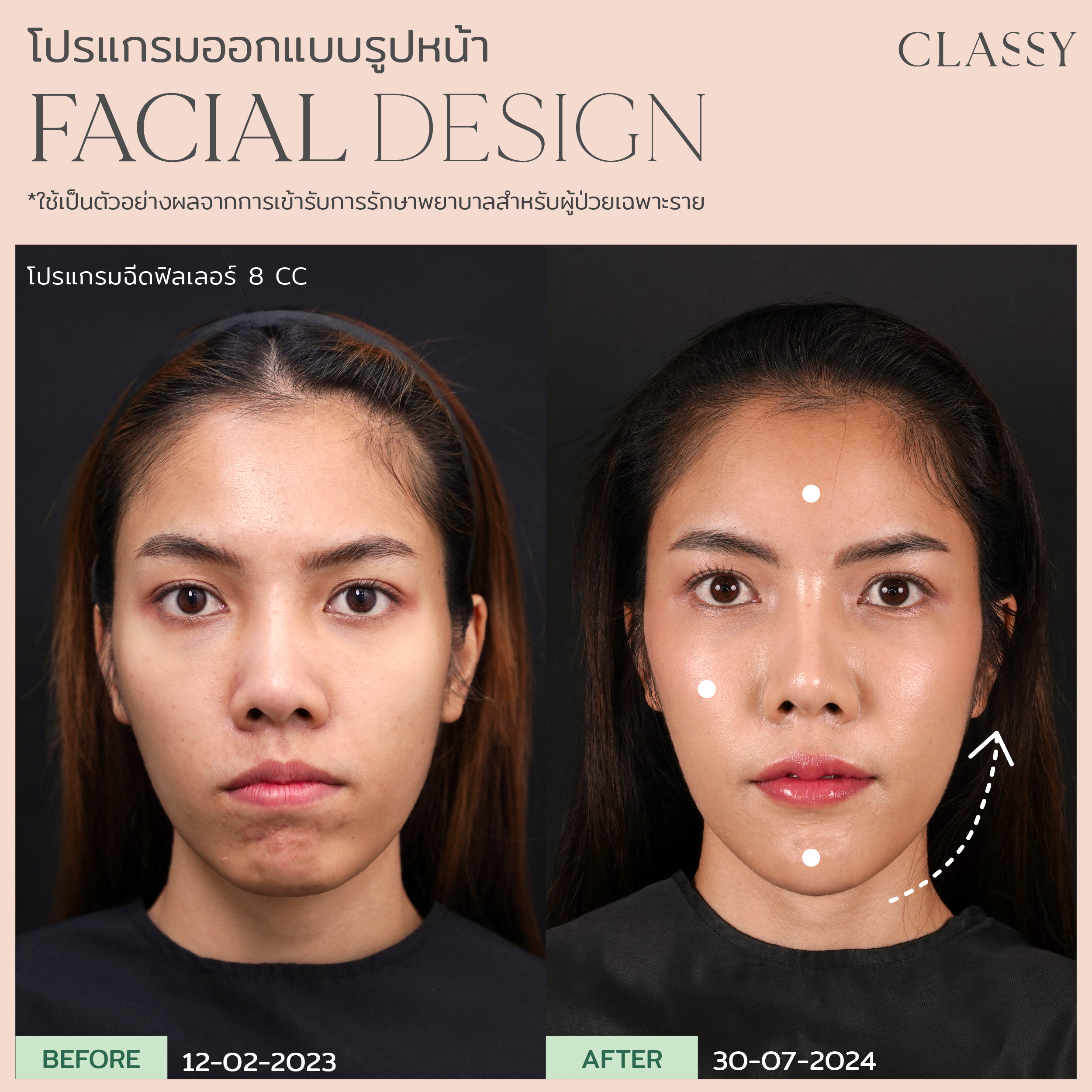 เทมเพลต รูปยาว-04 5