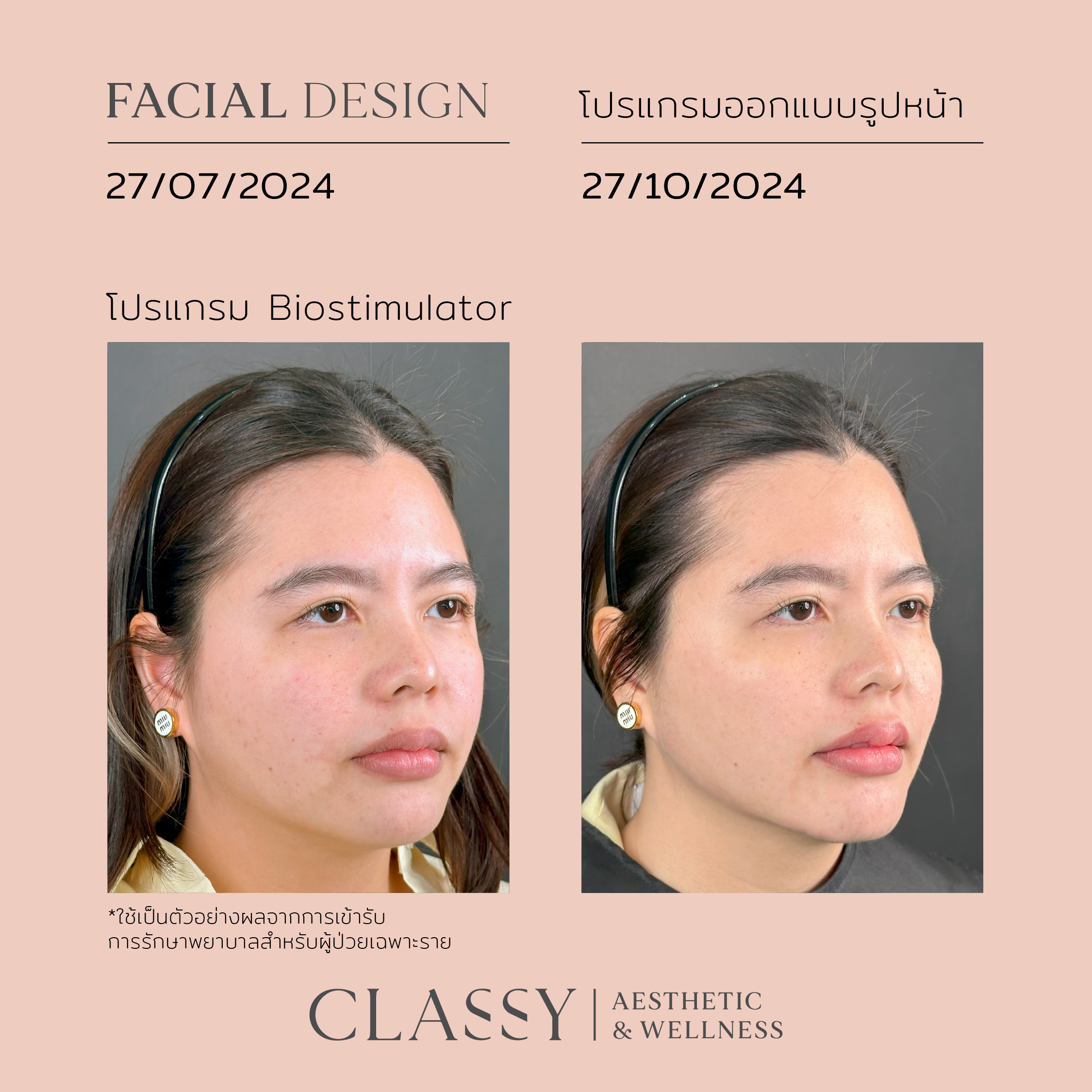เนส-10