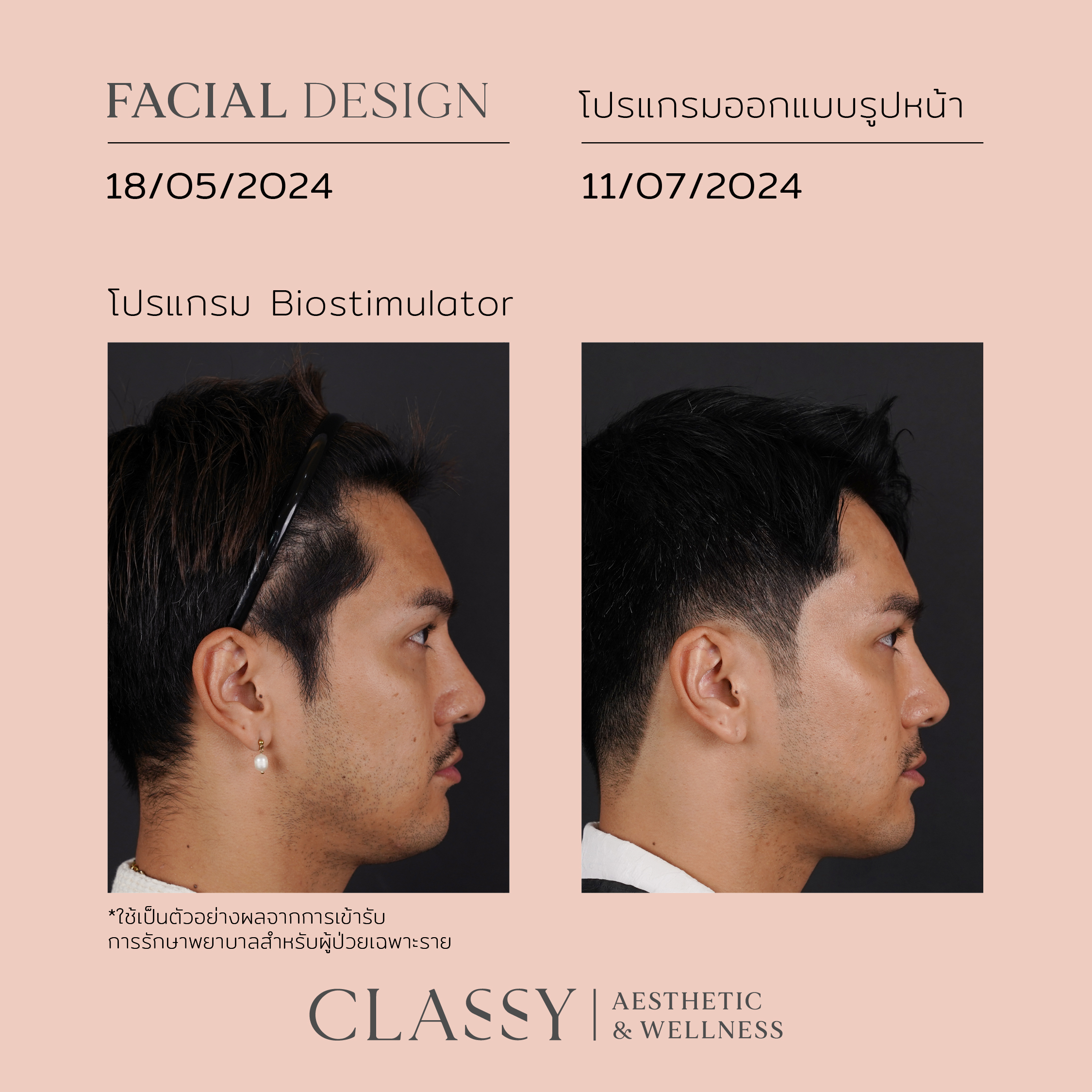เเมนสรวง-03