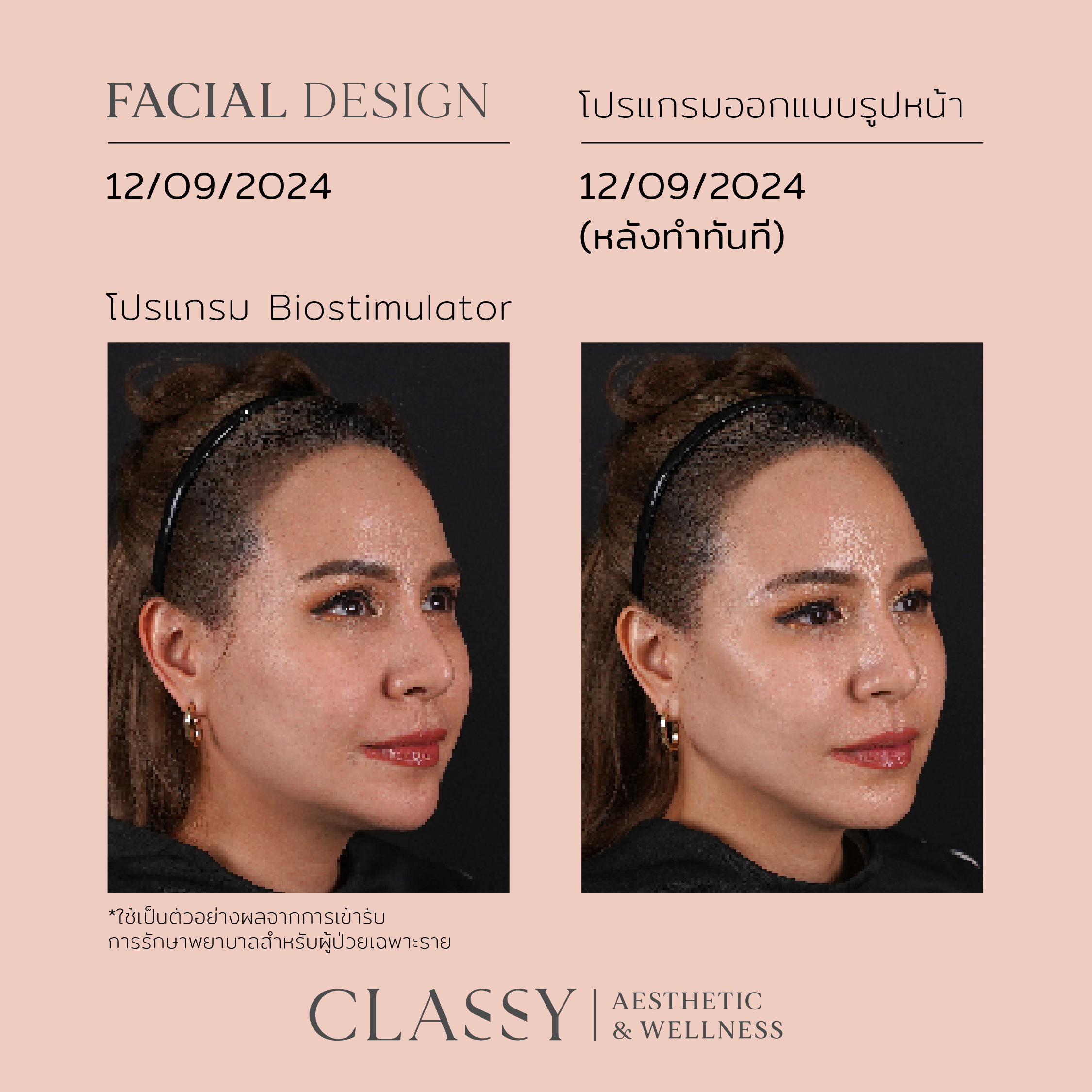 โบตั๋น-02