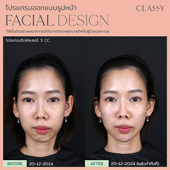 BA FACIAL DESIGN-06 2