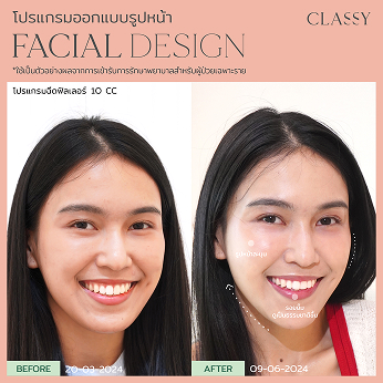 BA FACIAL DESIGN-06