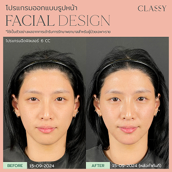 BA FACIAL DESIGN-16 1