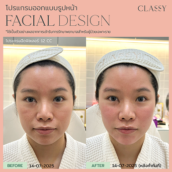 BA FACIAL DESIGN-16