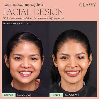 BA FACIAL DESIGN-20 1