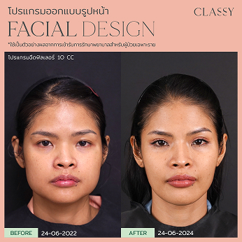 BA FACIAL DESIGN-21 1