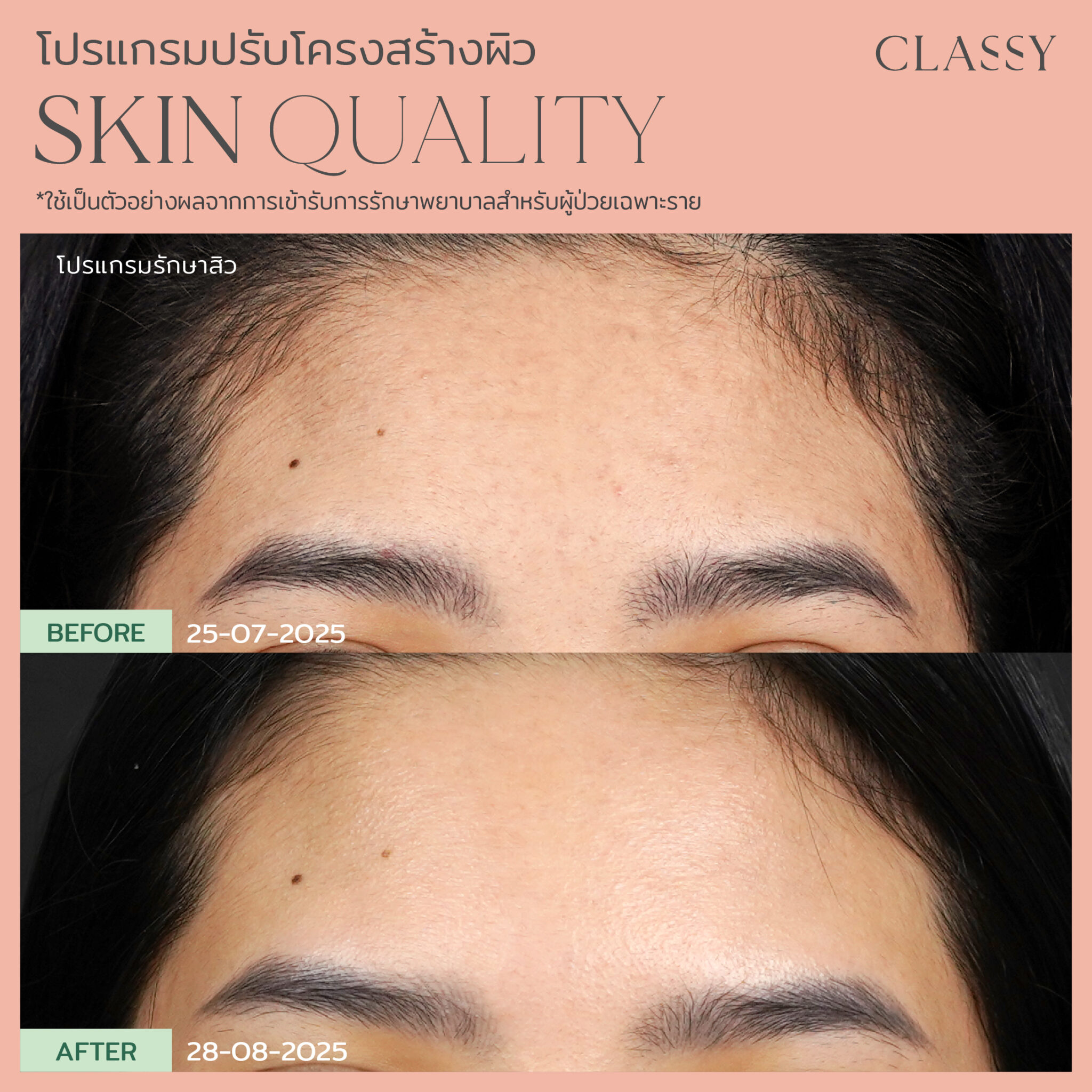 BA SKIN QUALITY-02