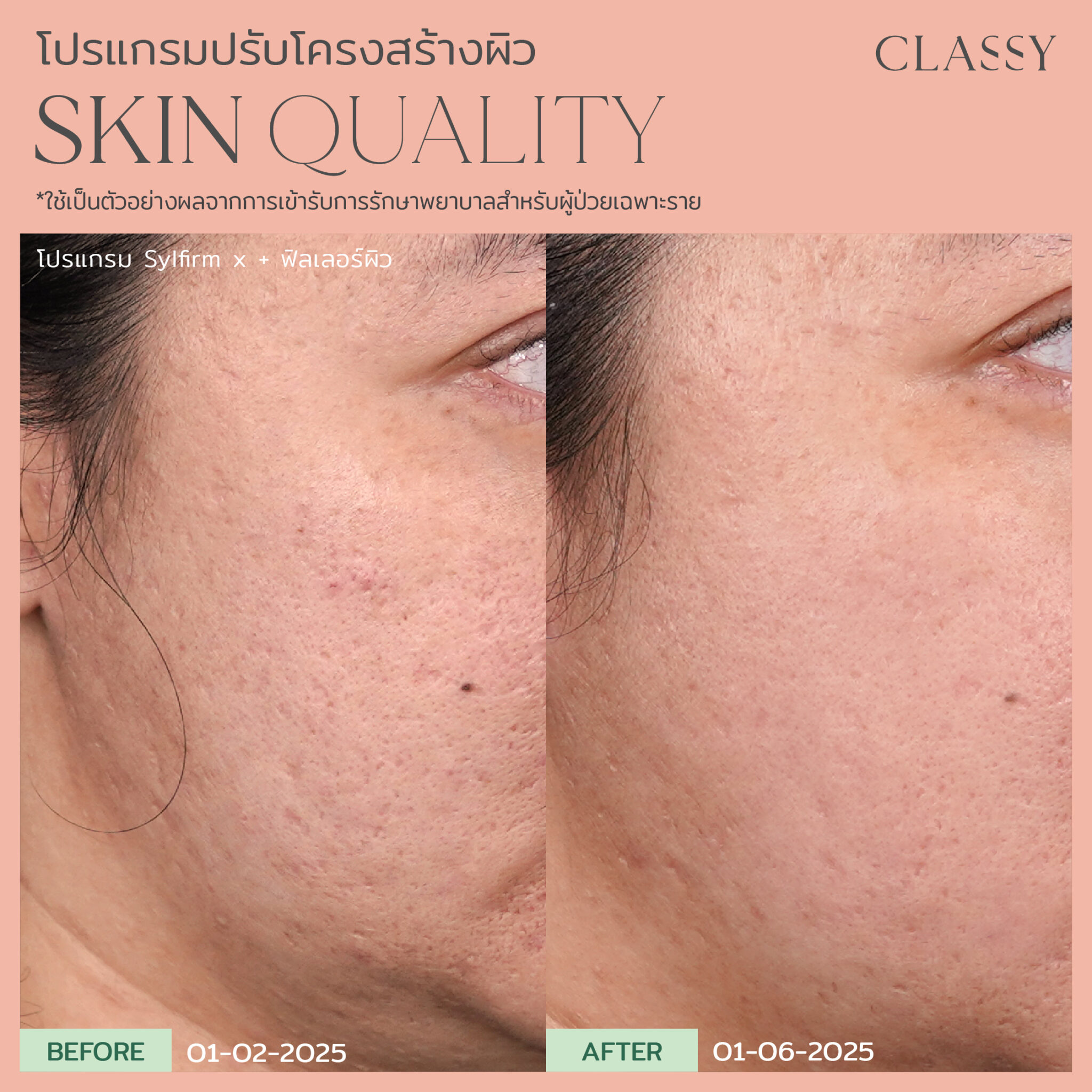 BA SKIN QUALITY-03
