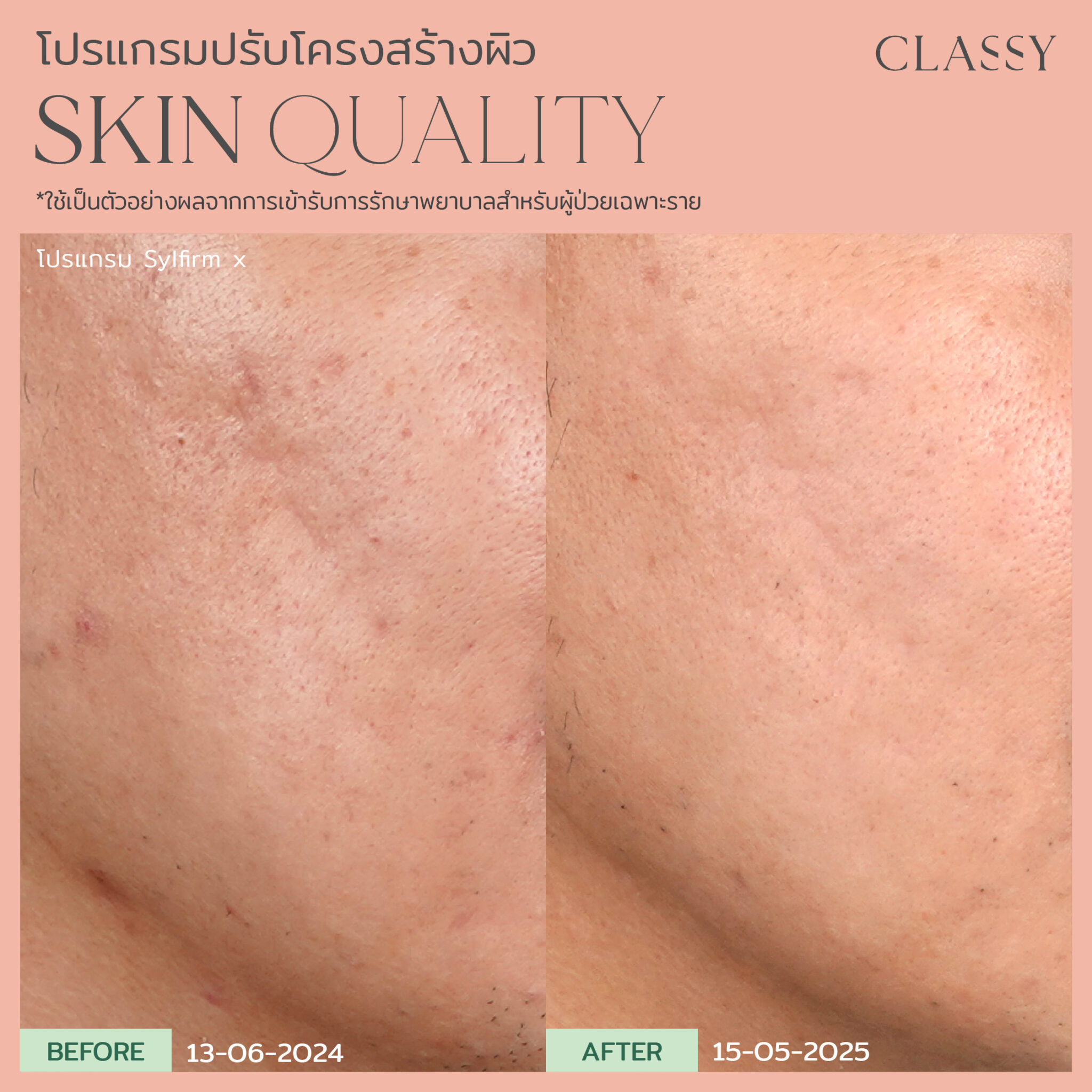 BA SKIN QUALITY-03