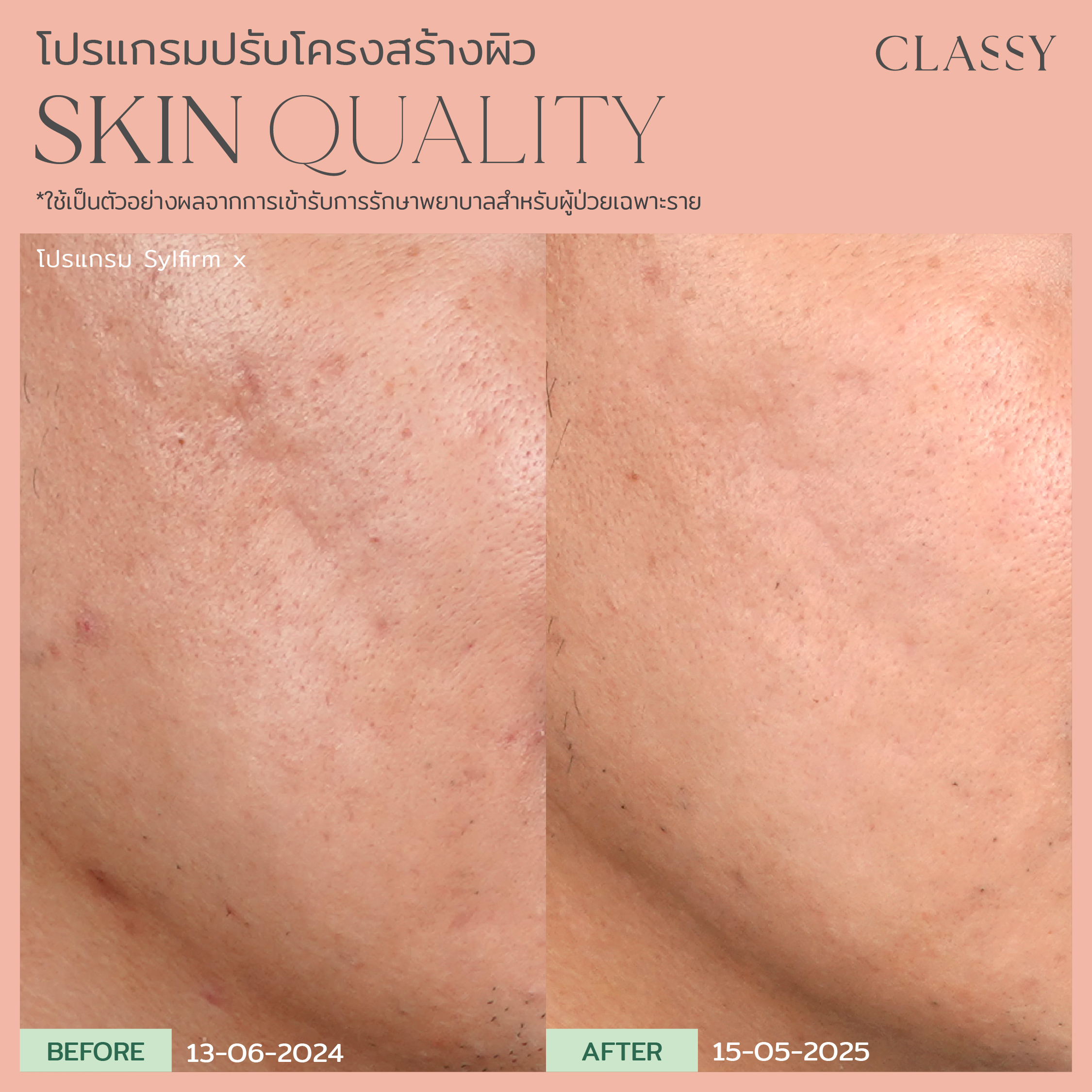 BA SKIN QUALITY-03