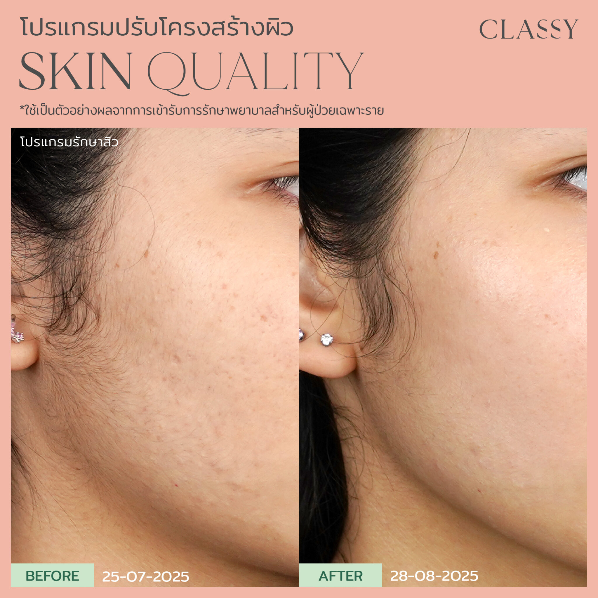 BA SKIN QUALITY-03