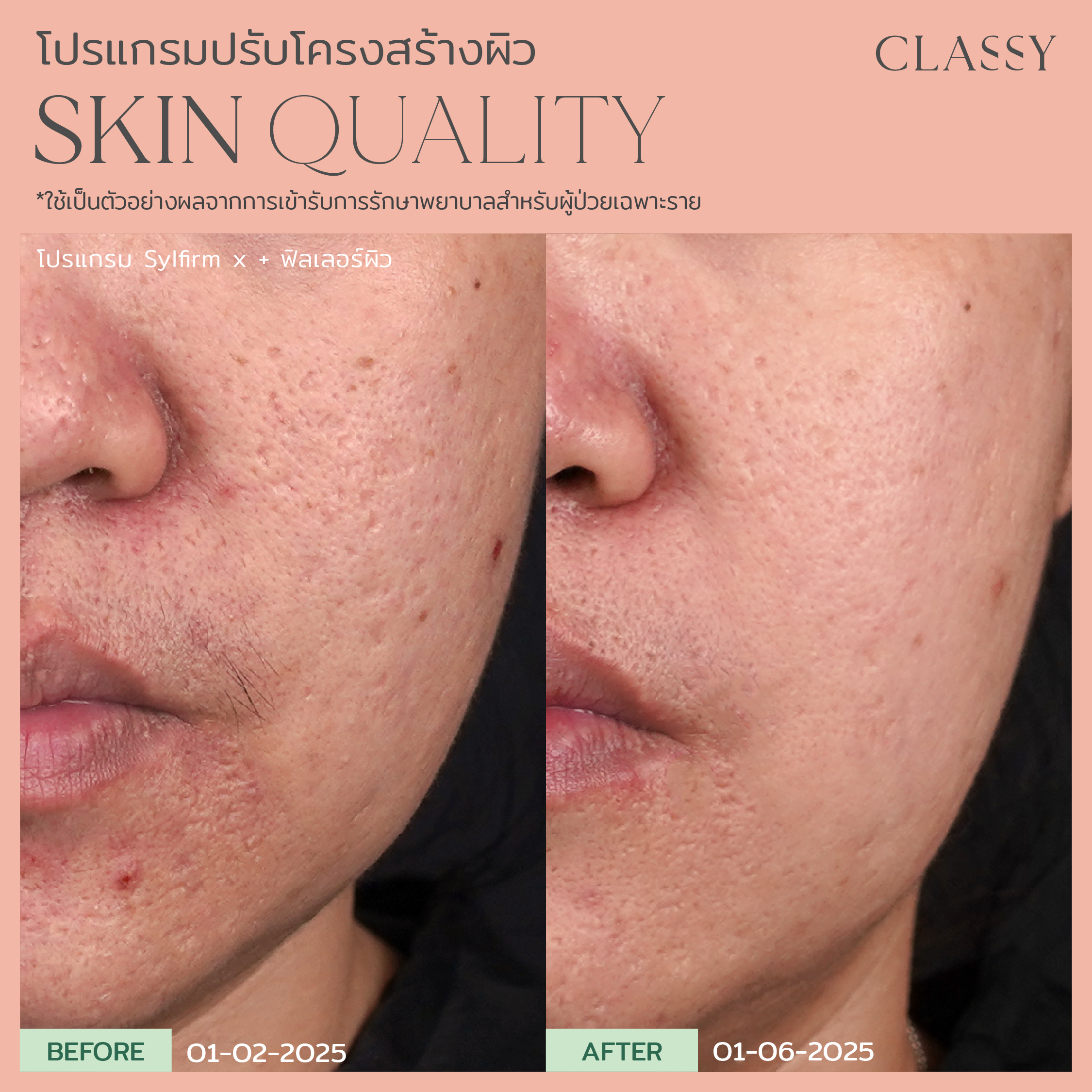 BA SKIN QUALITY-13