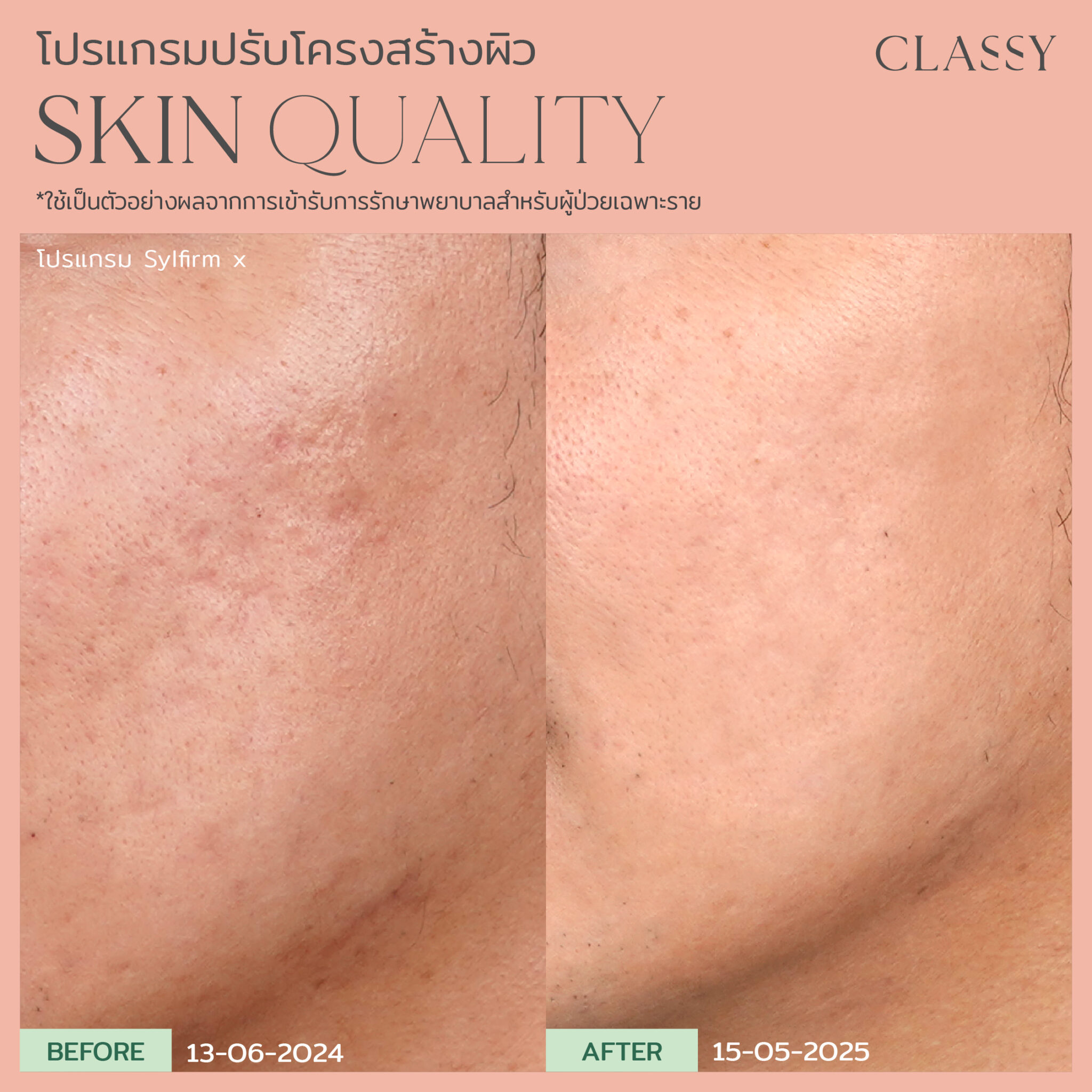 BA SKIN QUALITY-13