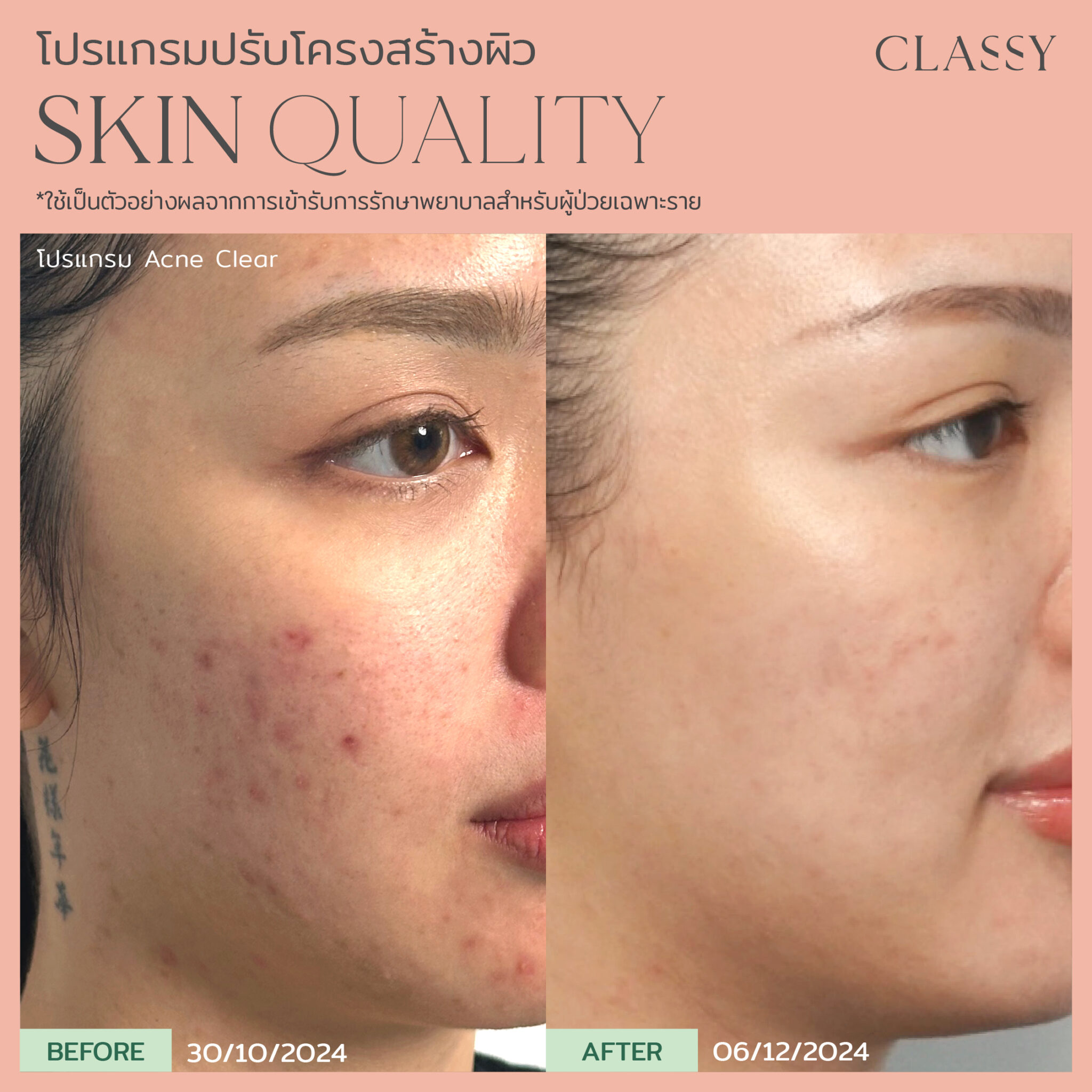 BA SKIN QUALITY-13