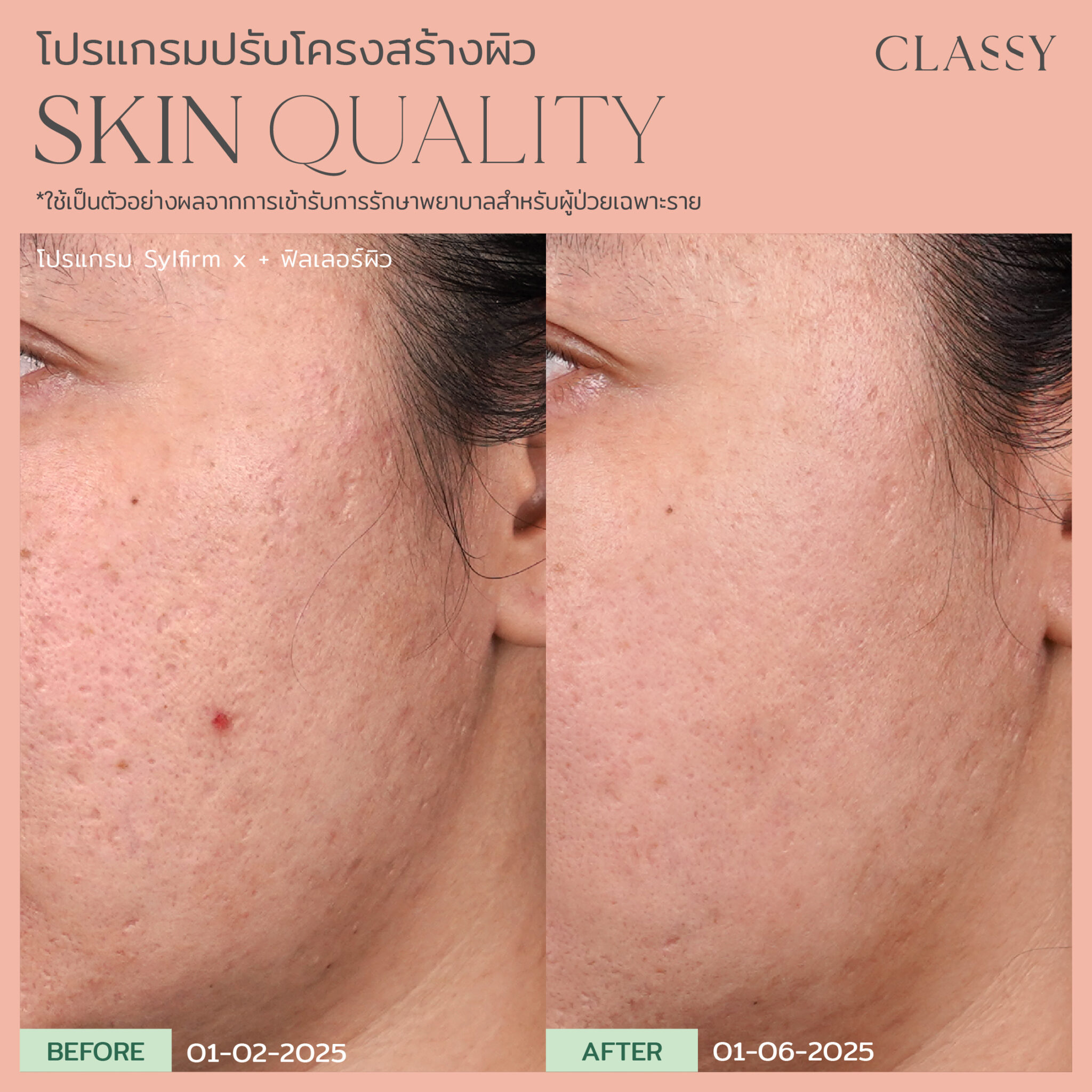 BA SKIN QUALITY-14