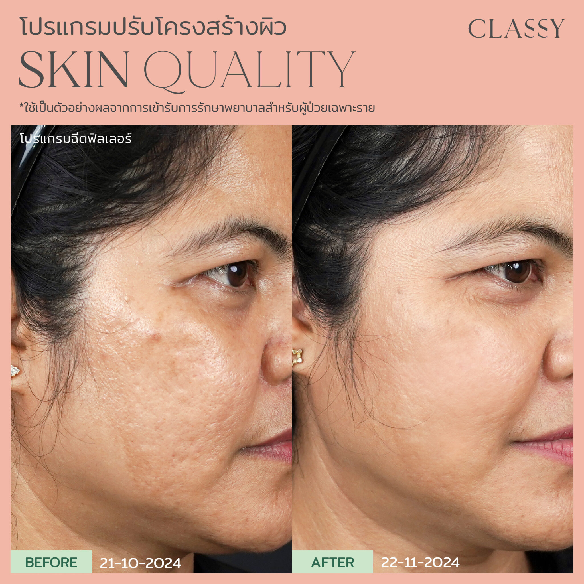 BA SKIN QUALITY-14