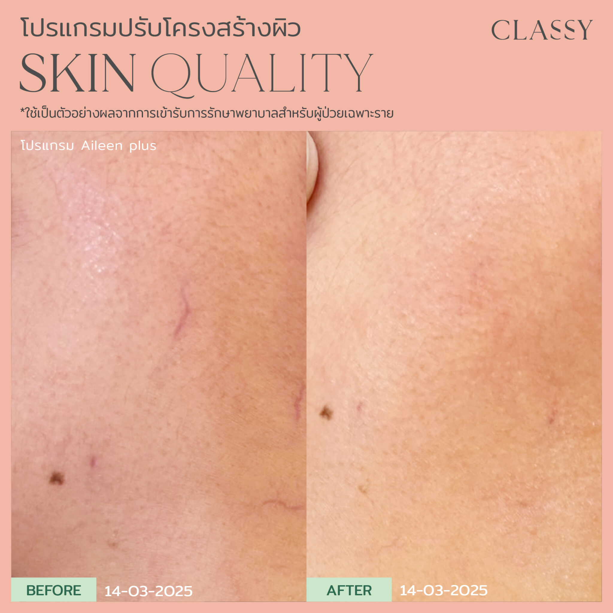 BA SKIN QUALITY-15