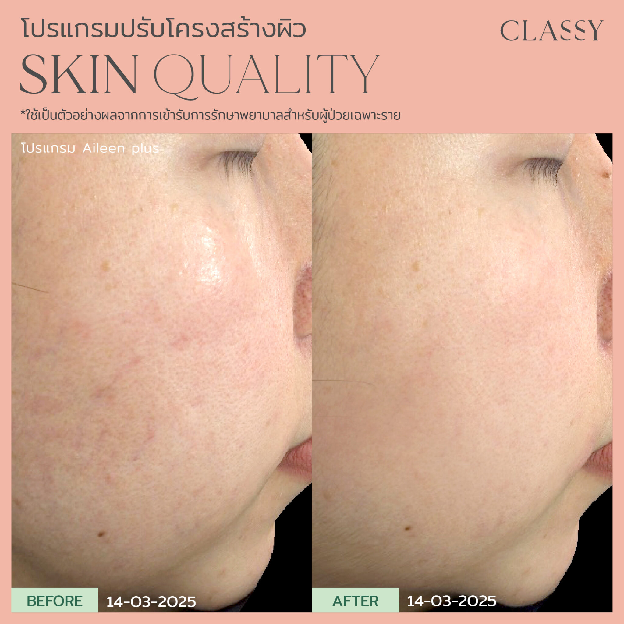 BA SKIN QUALITY-16